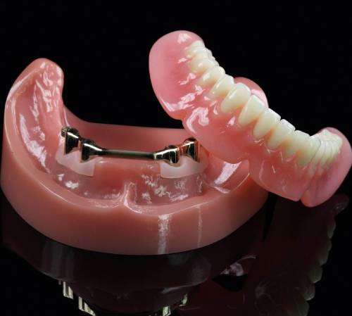 Протезирование зубов