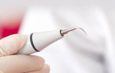 Лечение пародонтита