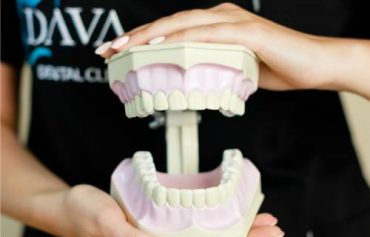 Имплантация и протезирование