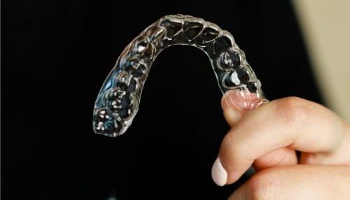 исправление прикуса