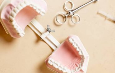 Одномоментная имплантация