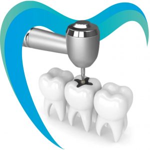 Лечение кариеса в Краснодаре