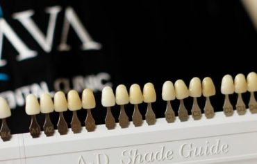 Протезирование зубов в Краснодаре