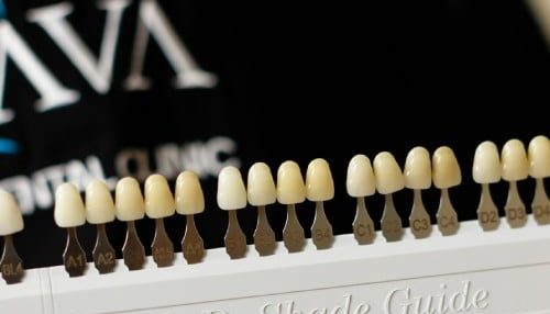 протезирование зубов Dava Dental