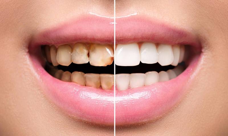 реставрация