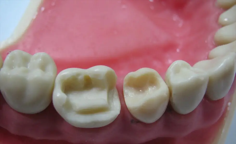 жевательные