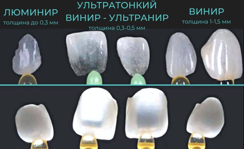 Viniry lyuminiry otlichiya