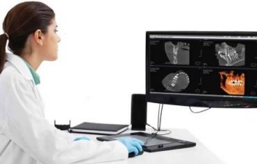 Конусно-лучевая компьютерная томография КЛКТ