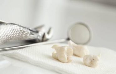 Лечение зубов мудрости